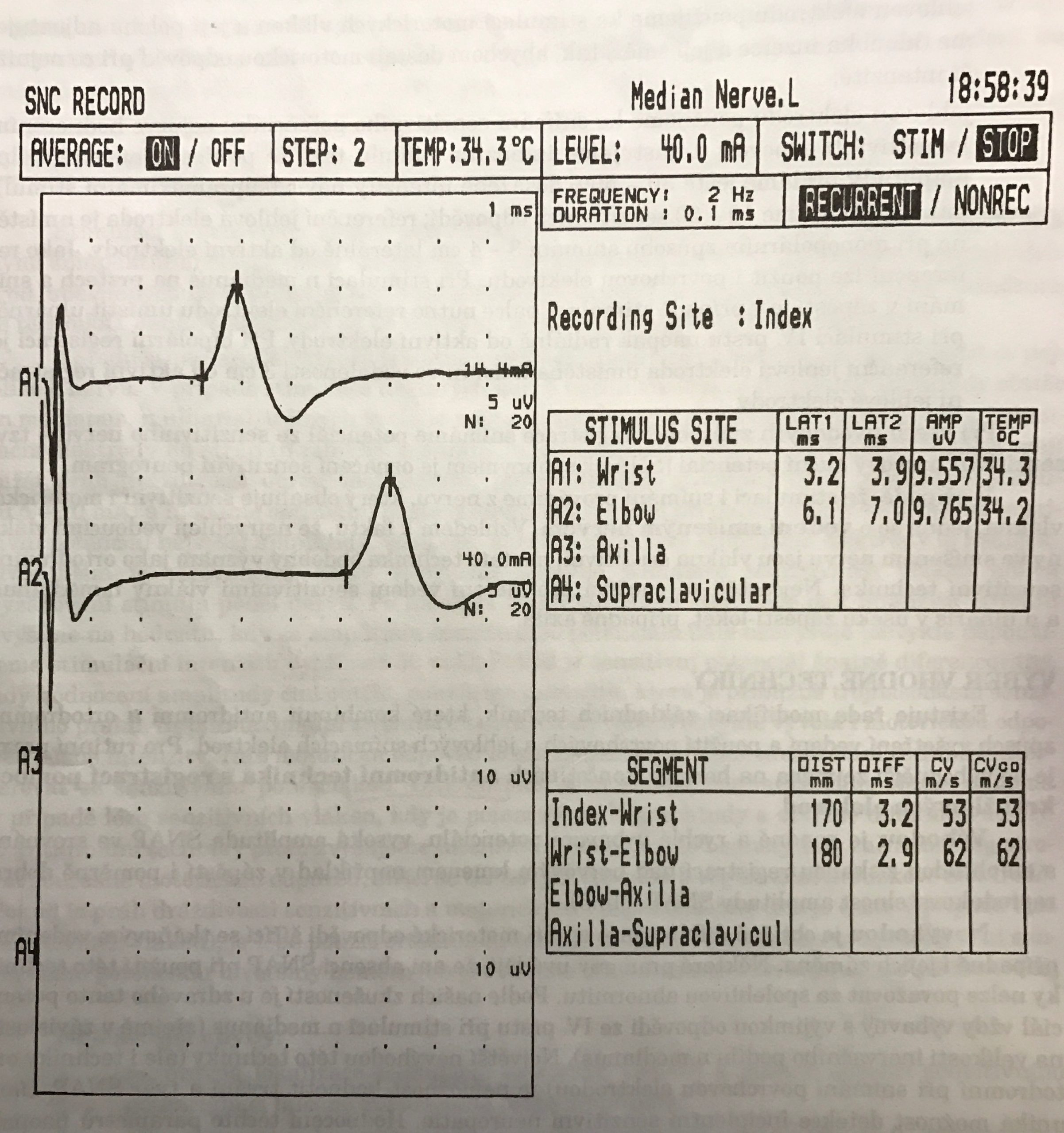 Électromyographe (EMG)