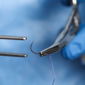 Sutures chirurgicales