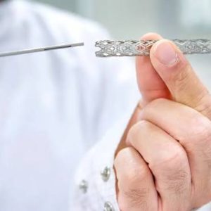 Stents uréthraux et urétéraux